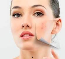 痘疤的图片,揭秘美丽肌肤的蜕变之路